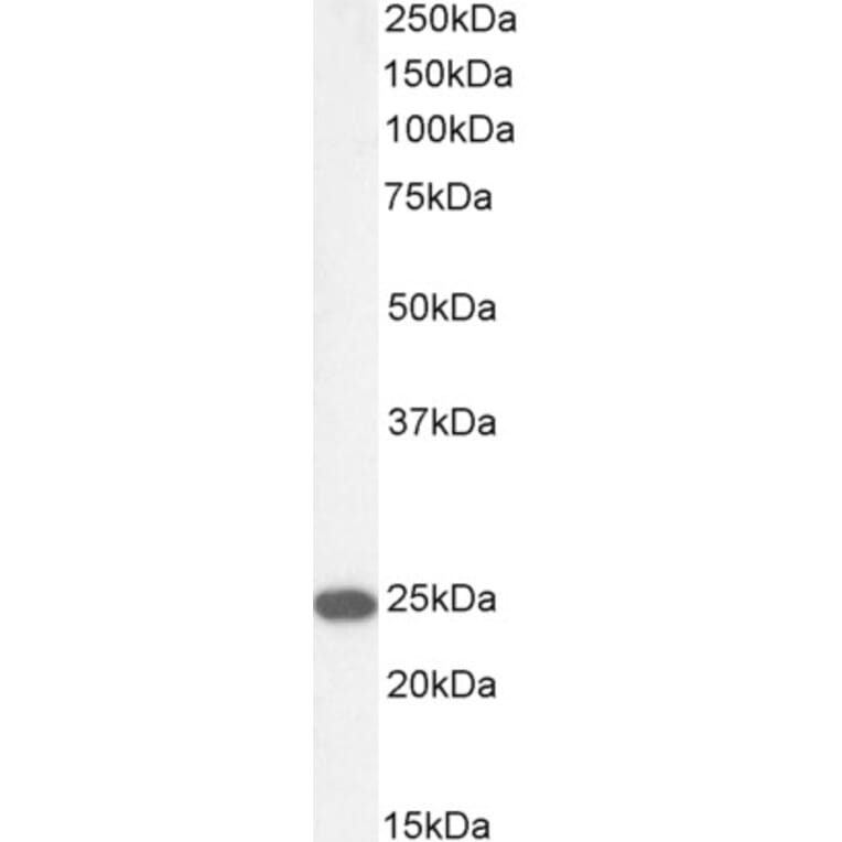Western Blot - Anti-Transgelin Antibody (A83697) - Antibodies.com