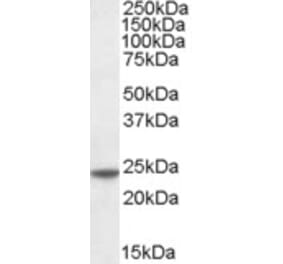 Western Blot - Anti-TAGLN Antibody (A83697)