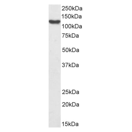 Western Blot - Anti-HLTF Antibody (A83698) - Antibodies.com