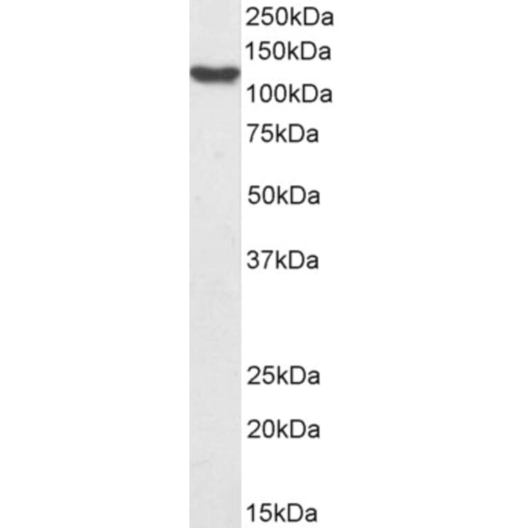 Western Blot - Anti-HLTF Antibody (A83698) - Antibodies.com