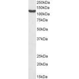 Western Blot - Anti-HLTF Antibody (A83698) - Antibodies.com