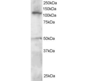 Western Blot - Anti-HLTF Antibody (A83698) - Antibodies.com