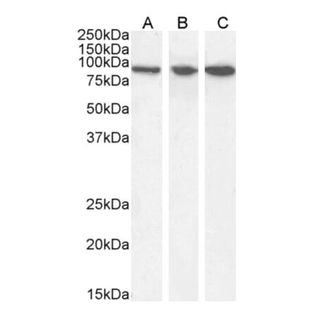 Western Blot - Anti-VPS35 Antibody (A83699) - Antibodies.com