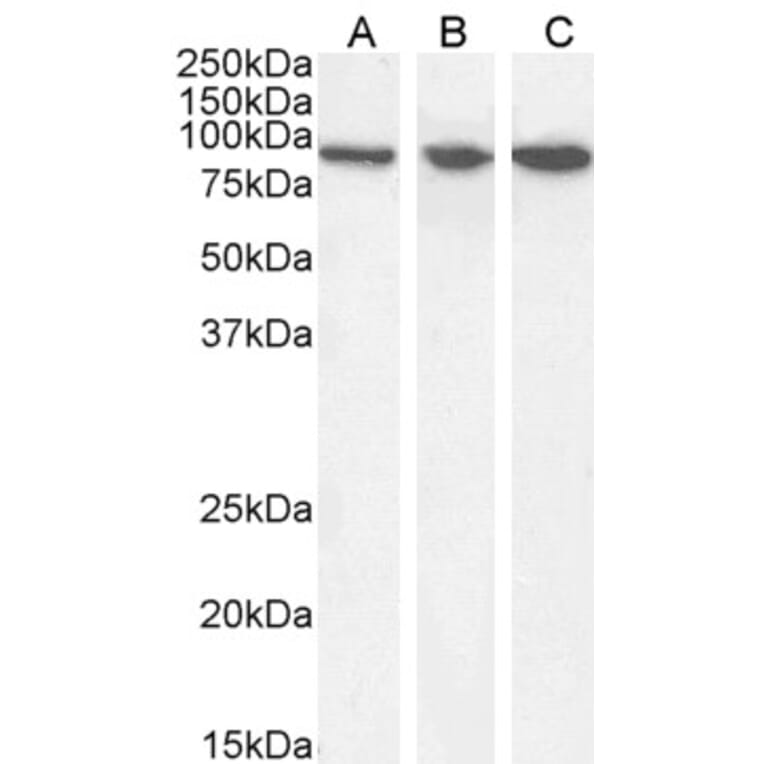 Western Blot - Anti-VPS35 Antibody (A83699) - Antibodies.com