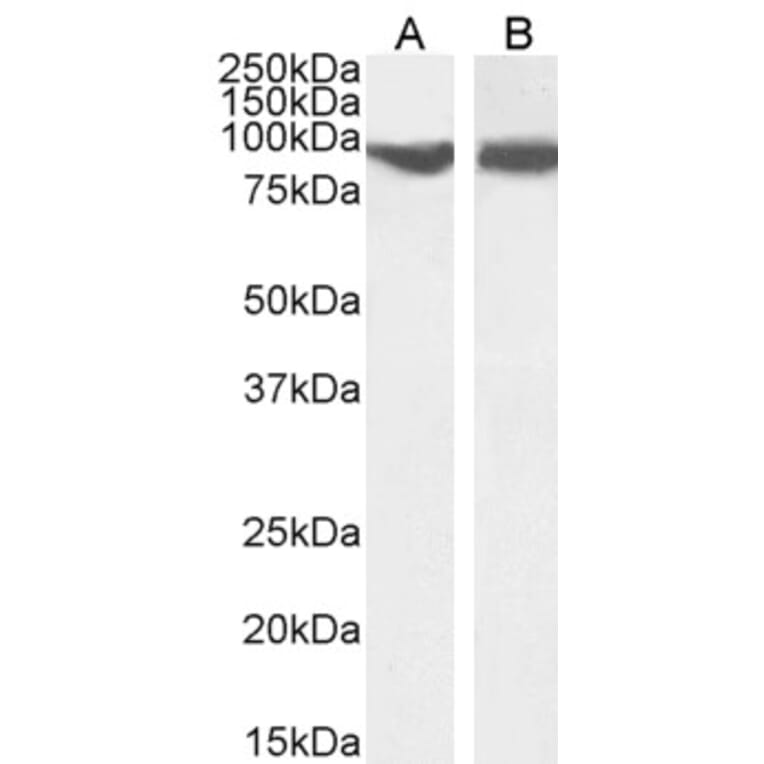 Western Blot - Anti-VPS35 Antibody (A83699) - Antibodies.com