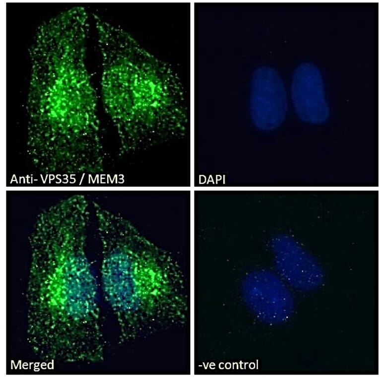 Immunofluorescence - Anti-VPS35 Antibody (A83699) - Antibodies.com