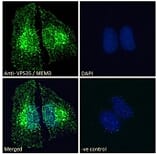 Immunofluorescence - Anti-VPS35 Antibody (A83699) - Antibodies.com