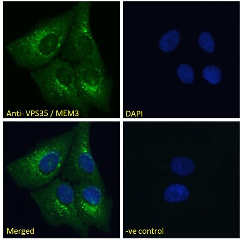 Immunofluorescence - Anti-VPS35 Antibody (A83699) - Antibodies.com