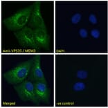 Immunofluorescence - Anti-VPS35 Antibody (A83699) - Antibodies.com