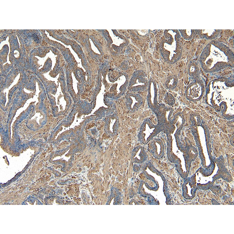 Immunohistochemistry - Anti-VPS35 Antibody (A83699) - Antibodies.com