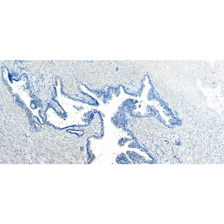 Immunohistochemistry - Anti-VPS35 Antibody (A83699) - Antibodies.com