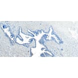 Immunohistochemistry - Anti-VPS35 Antibody (A83699) - Antibodies.com