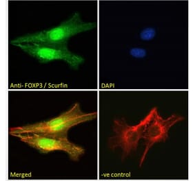 Immunofluorescence - Anti-FOXP3 Antibody (A83700) - Antibodies.com