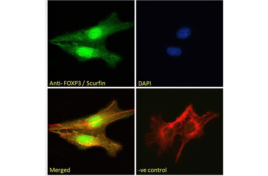 Immunofluorescence - Anti-FOXP3 Antibody (A83700) - Antibodies.com
