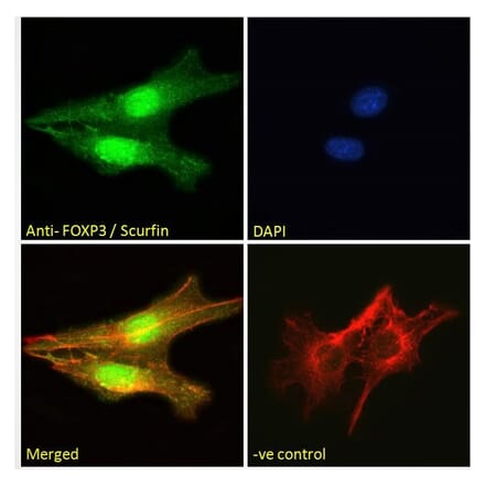 Immunofluorescence - Anti-FOXP3 Antibody (A83700) - Antibodies.com