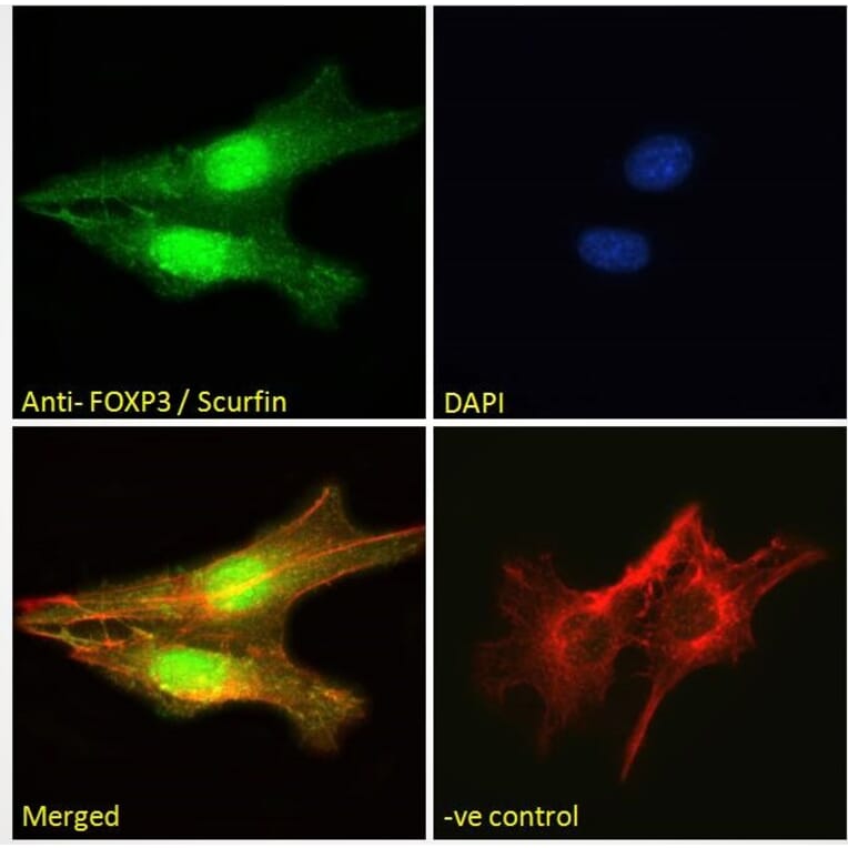 Immunofluorescence - Anti-FOXP3 Antibody (A83700) - Antibodies.com