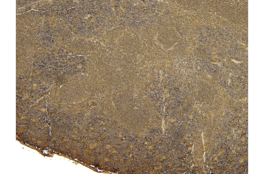 Immunohistochemistry - Anti-FOXP3 Antibody (A83700) - Antibodies.com