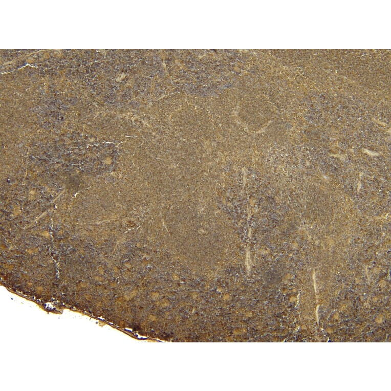 Immunohistochemistry - Anti-FOXP3 Antibody (A83700) - Antibodies.com