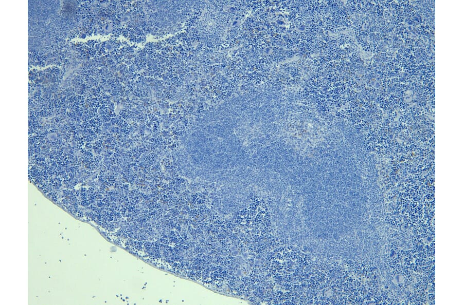 Immunohistochemistry - Anti-FOXP3 Antibody (A83700) - Antibodies.com