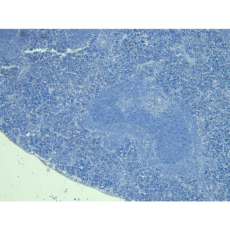 Immunohistochemistry - Anti-FOXP3 Antibody (A83700) - Antibodies.com
