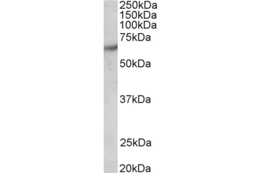 Western Blot - Anti-PAK1 Antibody (A83703) - Antibodies.com