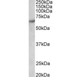 Western Blot - Anti-PAK1 Antibody (A83703) - Antibodies.com