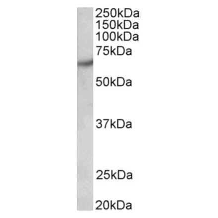 Western Blot - Anti-PAK1 Antibody (A83703) - Antibodies.com