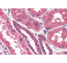 Immunohistochemistry - Anti-ITPR2 Antibody (A83704) - Antibodies.com