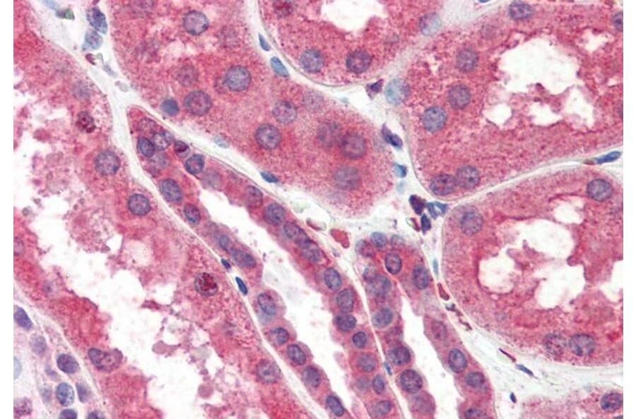 Immunohistochemistry - Anti-ITPR2 Antibody (A83704) - Antibodies.com