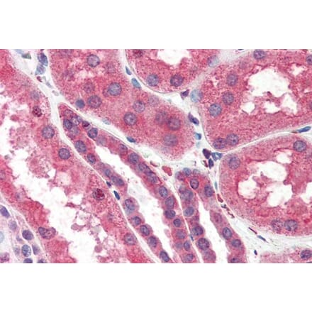 Immunohistochemistry - Anti-ITPR2 Antibody (A83704) - Antibodies.com