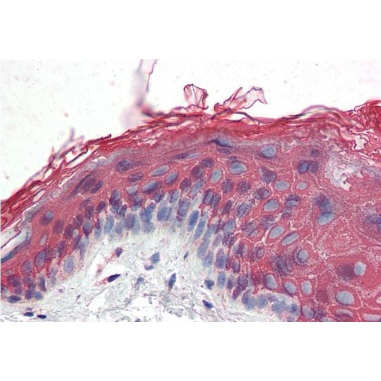 Immunohistochemistry - Anti-ITPR2 Antibody (A83704) - Antibodies.com