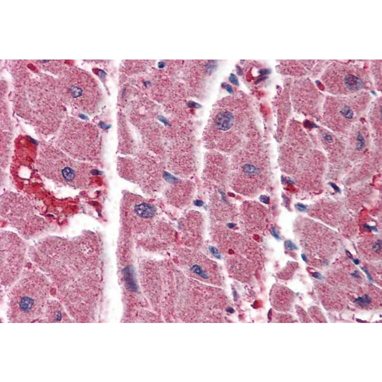 Immunohistochemistry - Anti-ITPR2 Antibody (A83704) - Antibodies.com