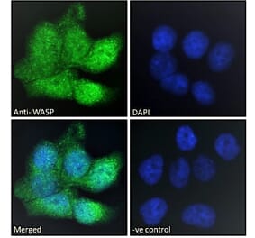 Immunofluorescence - Anti-WASP Antibody (A83705) - Antibodies.com