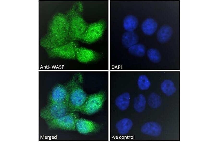 Immunofluorescence - Anti-WASP Antibody (A83705) - Antibodies.com