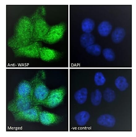 Immunofluorescence - Anti-WASP Antibody (A83705) - Antibodies.com