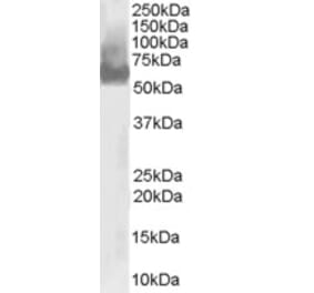 Western Blot - Anti-WAS Antibody (A83705) - Antibodies.com