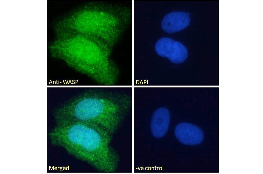 Immunofluorescence - Anti-WASP Antibody (A83705) - Antibodies.com