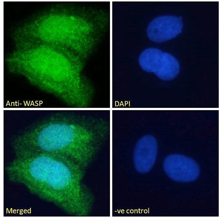 Immunofluorescence - Anti-WASP Antibody (A83705) - Antibodies.com