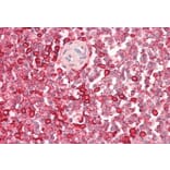 Immunohistochemistry - Anti-WASP Antibody (A83705) - Antibodies.com