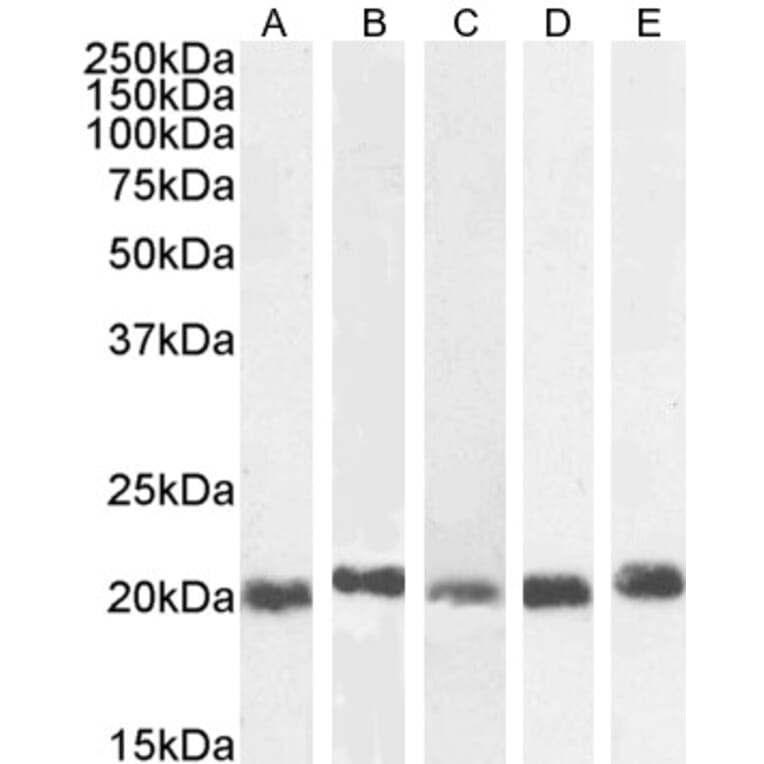 Western Blot - Anti-HP1 gamma/CBX3 Antibody (A83707) - Antibodies.com