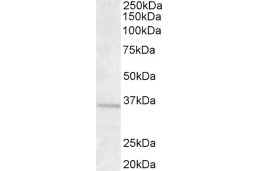 Western Blot - Anti-GNB3 Antibody (A83708) - Antibodies.com