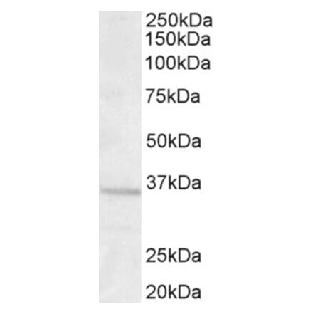 Western Blot - Anti-GNB3 Antibody (A83708) - Antibodies.com