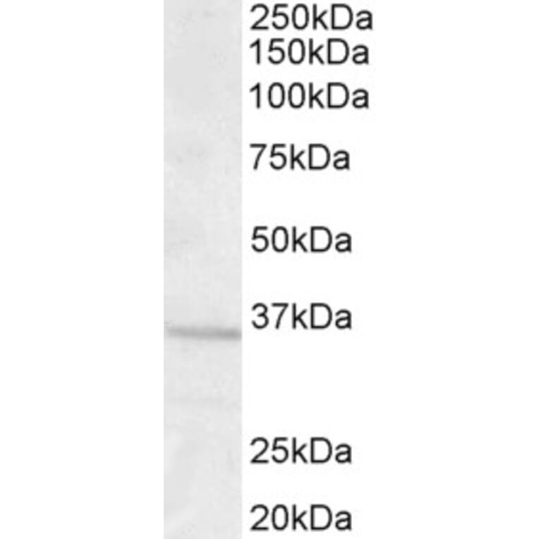 Western Blot - Anti-GNB3 Antibody (A83708) - Antibodies.com