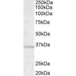 Western Blot - Anti-GNB3 Antibody (A83708) - Antibodies.com