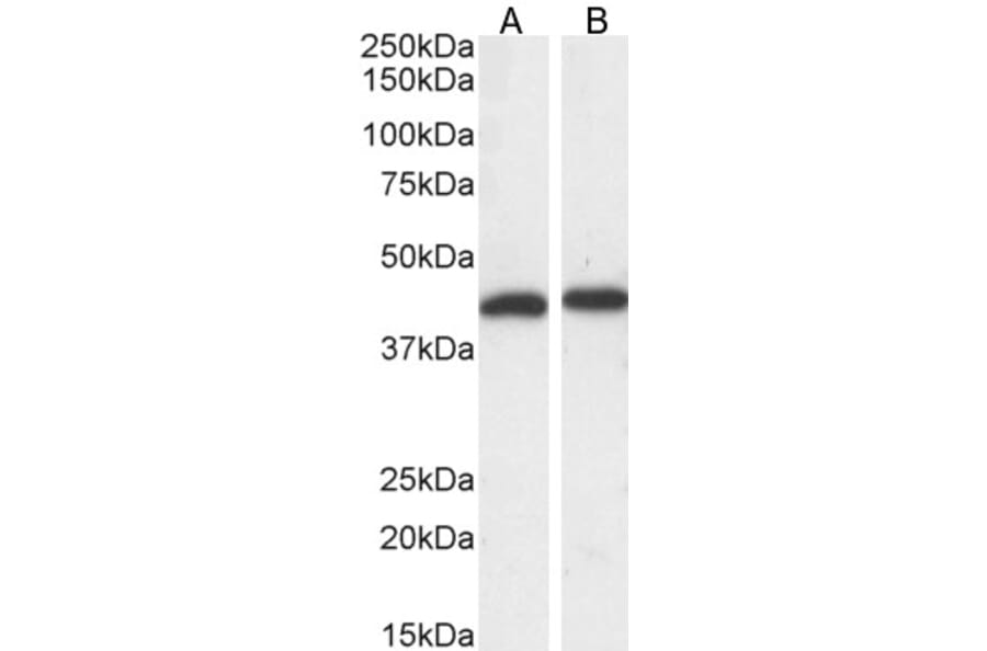 Western Blot - Anti-ERK1 Antibody (A83709) - Antibodies.com