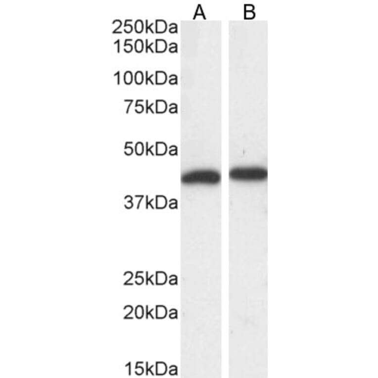 Western Blot - Anti-ERK1 Antibody (A83709) - Antibodies.com