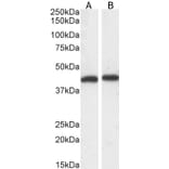 Western Blot - Anti-ERK1 Antibody (A83709) - Antibodies.com