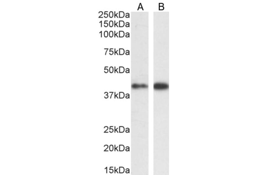 Western Blot - Anti-ERK1 Antibody (A83709) - Antibodies.com