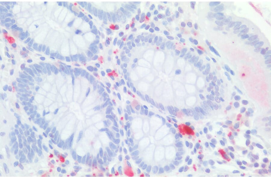 Immunohistochemistry - Anti-CDX2 Antibody (A83711) - Antibodies.com