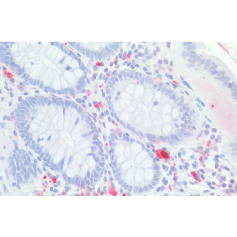 Immunohistochemistry - Anti-CDX2 Antibody (A83711) - Antibodies.com